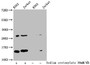 Western Blot; Detected samples: K562 whole cell lysate, Jurkat whole cell lysate; Untreated (-) or treated (+) with 30mM Sodium crotonylate for 4h; All lanes: HIST1H2BC antibody at 1:100; Secondary; Goat polyclonal to rabbit IgG at 1/50000 dilution; Predicted band size: 14 kDa; Observed band size: 14 kDa Western Blot; Detected samples: K562 whole cell lysate, Jurkat whole cell lysate; Untreated (-) or treated (+) with 30mM Sodium crotonylate for 4h; All lanes: HIST1H2BC antibody at 1:100; Secondary; Goat polyclonal to rabbit IgG at 1/50000 dilution; Predicted band size: 14 kDa; Observed band size: 14 kDa