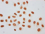 Immunocytochemistry analysis diluted at 1:30 and staining in Hela cells (treated with 30mM sodium butyrate for 4h) performed on a Leica BondTM system. The cells were fixed in 4% formaldehyde, permeabilized using 0.2% Triton X-100 and blocked with 10% normal goat serum 30min at RT. Then primary antibody (1% BSA) was incubated at 4°C overnight. The primary is detected by a biotinylated secondary antibody and visualized using an HRP conjugated SP system.