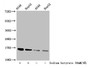 Western Blot; Detected samples: A549 whole cell lysate, HepG2 whole cell lysate; Untreated (-) or treated (+) with 30mM sodium butyrate for 4h; All lanes: HIST1H3A antibody at 1:100; Secondary; Goat polyclonal to rabbit IgG at 1/50000 dilution; Predicted band size: 16 kDa; Observed band size: 16 kDa