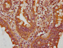 IHC image diluted at 1:200 and staining in paraffin-embedded human small intestine tissue performed on a Leica BondTM system. After dewaxing and hydration, antigen retrieval was mediated by high pressure in a citrate buffer (pH 6.0). Section was blocked with 10% normal goat serum 30min at RT. Then primary antibody (1% BSA) was incubated at 4°C overnight. The primary is detected by a biotinylated secondary antibody and visualized using an HRP conjugated SP system.