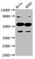 Western Blot; Positive WB detected in: Hela whole cell lysate, K562 whole cell lysate; All lanes: CYP7A1 antibody at 4.5µg/ml; Secondary; Goat polyclonal to rabbit IgG at 1/50000 dilution; Predicted band size: 58 kDa; Observed band size: 58 kDa Western Blot; Positive WB detected in: Hela whole cell lysate, K562 whole cell lysate; All lanes: CYP7A1 antibody at 4.5µg/ml; Secondary; Goat polyclonal to rabbit IgG at 1/50000 dilution; Predicted band size: 58 kDa; Observed band size: 58 kDa