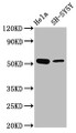 Western Blot; Positive WB detected in: Hela whole cell lysate, SH-SY5Y whole cell lysate; All lanes: MEX3A antibody at 4.3µg/ml; Secondary; Goat polyclonal to rabbit IgG at 1/50000 dilution; Predicted band size: 55 kDa; Observed band size: 55 kDa