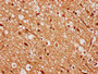 IHC image diluted at 1:300 and staining in paraffin-embedded human brain tissue performed on a Leica BondTM system. After dewaxing and hydration, antigen retrieval was mediated by high pressure in a citrate buffer (pH 6.0). Section was blocked with 10% normal goat serum 30min at RT. Then primary antibody (1% BSA) was incubated at 4°C overnight. The primary is detected by a biotinylated secondary antibody and visualized using an HRP conjugated SP system.