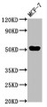 Western Blot; Positive WB detected in: MCF-7 whole cell lysate; All lanes: CCDC6 antibody at 3µg/ml; Secondary; Goat polyclonal to rabbit IgG at 1/50000 dilution; Predicted band size: 54 kDa; Observed band size: 54 kDa
