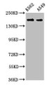 Western Blot; Positive WB detected in: K562 whole cell lysate, A549 whole cell lysate; All lanes: FMN1 antibody at 3.9µg/ml; Secondary; Goat polyclonal to rabbit IgG at 1/50000 dilution; Predicted band size: 158, 72, 54, 133 kDa; Observed band size: 158 kDa