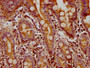 IHC image diluted at 1:300 and staining in paraffin-embedded human small intestine tissue performed on a Leica BondTM system. After dewaxing and hydration, antigen retrieval was mediated by high pressure in a citrate buffer (pH 6.0). Section was blocked with 10% normal goat serum 30min at RT. Then primary antibody (1% BSA) was incubated at 4°C overnight. The primary is detected by a biotinylated secondary antibody and visualized using an HRP conjugated SP system.