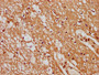 IHC image of CAC11557 diluted at 1:400 and staining in paraffin-embedded human brain tissue performed on a Leica BondTM system. After dewaxing and hydration, antigen retrieval was mediated by high pressure in a citrate buffer (pH 6.0). Section was blocked with 10% normal goat serum 30min at RT. Then primary antibody (1% BSA) was incubated at 4°C overnight. The primary is detected by a biotinylated secondary antibody and visualized using an HRP conjugated SP system.
