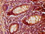 IHC image diluted at 1:200 and staining in paraffin-embedded human appendix tissue performed on a Leica BondTM system. After dewaxing and hydration, antigen retrieval was mediated by high pressure in a citrate buffer (pH 6.0). Section was blocked with 10% normal goat serum 30min at RT. Then primary antibody (1% BSA) was incubated at 4°C overnight. The primary is detected by a biotinylated secondary antibody and visualized using an HRP conjugated SP system.