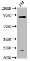 Western Blot; Positive WB detected in: 293 whole cell lysate; All lanes: HOOK3 antibody at 4.9µg/ml; Secondary; Goat polyclonal to rabbit IgG at 1/50000 dilution; Predicted band size: 84 kDa; Observed band size: 84 kDa