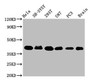 Western Blot; Positive WB detected in: Hela whole cell lysate, SH-SY5Y whole cell lysate, 293T whole cell lysate, U87 whole cell lysate, PC-3 whole cell lysate, Rat brain tissue; All lanes: KTI12 antibody at 3.2µg/ml; Secondary; Goat polyclonal to rabbit IgG at 1/50000 dilution; Predicted band size: 39 kDa; Observed band size: 39 kDa