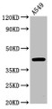 Western Blot; Positive WB detected in: A549 whole cell lysate; All lanes: CHST14 antibody at 4.8µg/ml; Secondary; Goat polyclonal to rabbit IgG at 1/50000 dilution; Predicted band size: 43 kDa; Observed band size: 43 kDa