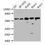 Western Blot; Positive WB detected in: U87 whole cell lysate, SH-SY5Y whole cell lysate, HepG2 whole cell lysate, Mouse brain tissue, Rat heart tissue; All lanes: CPNE7 antibody at 3.6µg/ml; Secondary; Goat polyclonal to rabbit IgG at 1/50000 dilution; Predicted band size: 71, 62 kDa; Observed band size: 62 kDa