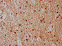 IHC image diluted at 1:300 and staining in paraffin-embedded human brain tissue performed on a Leica BondTM system. After dewaxing and hydration, antigen retrieval was mediated by high pressure in a citrate buffer (pH 6.0). Section was blocked with 10% normal goat serum 30min at RT. Then primary antibody (1% BSA) was incubated at 4°C overnight. The primary is detected by a biotinylated secondary antibody and visualized using an HRP conjugated SP system.