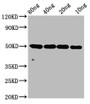 Western Blot; Positive WB detected in Recombinant protein; All lanes: ntpcr antibody at 4µg/ml; Secondary; Goat polyclonal to rabbit IgG at 1/50000 dilution; Predicted band size: 50 kDa; Observed band size: 50 kDa