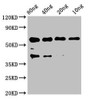 Western Blot; Positive WB detected in Recombinant protein; All lanes: egf antibody at 2.6µg/ml; Secondary; Goat polyclonal to rabbit IgG at 1/50000 dilution; Predicted band size: 43 kDa; Observed band size: 60 kDa
