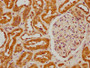 IHC image diluted at 1:300 and staining in paraffin-embedded human kidney tissue performed on a Leica BondTM system. After dewaxing and hydration, antigen retrieval was mediated by high pressure in a citrate buffer(pH 6.0). Section was blocked with 10% normal goat serum 30min at RT. Then primary antibody(1% BSA) was incubated at 4°C overnight. The primary is detected by a biotinylated secondary antibody and visualized using an HRP conjugated SP system.