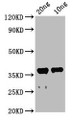 Western Blot; Positive WB detected in Recombinant protein; All lanes: ache antibody at 2.3µg/ml; Secondary; Goat polyclonal to rabbit IgG at 1/50000 dilution; Predicted band size: 44 kDa; Observed band size: 38 kDa