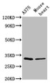 Western Blot; Positive WB detected in: A375 whole cell lysate, Mouse heart tissue; All lanes: TIMMDC1 antibody at 2.9µg/ml; Secondary; Goat polyclonal to rabbit IgG at 1/50000 dilution; Predicted band size: 33 kDa; Observed band size: 33 kDa