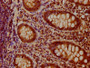 IHC image diluted at 1:100 and staining in paraffin-embedded human appendix tissue performed on a Leica BondTM system. After dewaxing and hydration, antigen retrieval was mediated by high pressure in a citrate buffer (pH 6.0). Section was blocked with 10% normal goat serum 30min at RT. Then primary antibody (1% BSA) was incubated at 4°C overnight. The primary is detected by a biotinylated secondary antibody and visualized using an HRP conjugated SP system.