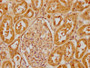 IHC image diluted at 1:400 and staining in paraffin-embedded human kidney tissue performed on a Leica BondTM system. After dewaxing and hydration, antigen retrieval was mediated by high pressure in a citrate buffer (pH 6.0). Section was blocked with 10% normal goat serum 30min at RT. Then primary antibody (1% BSA) was incubated at 4°C overnight. The primary is detected by a biotinylated secondary antibody and visualized using an HRP conjugated SP system.