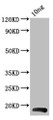 Western Blot; Positive WB detected in Recombinant protein; All lanes: BHRF1 antibody at 4µg/ml; Secondary; Goat polyclonal to rabbit IgG at 1/50000 dilution; Predicted band size: 18 kDa; Observed band size: 18 kDa;