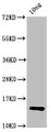 Western Blot; Positive WB detected in Recombinant protein; All lanes: P antibody at 2.7µg/ml; Secondary; Goat polyclonal to rabbit IgG at 1/50000 dilution; Predicted band size: 14 kDa; Observed band size: 14 kDa