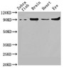 Western Blot; Positive WB detected in: Zebrafish tissue, Zebrafish brain tissue, Zebrafish heart tissue, Zebrafish eye tissue; All lanes: vcp antibody at 1.8µg/ml; Secondary; Goat polyclonal to rabbit IgG at 1/50000 dilution; Predicted band size: 90 kDa; Observed band size: 90 kDa;