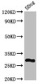 Western Blot; Positive WB detected in Recombinant protein; All lanes: L antibody at 7µg/ml; Secondary; Goat polyclonal to rabbit IgG at 1/50000 dilution; Predicted band size: 28 kDa; Observed band size: 28 kDa