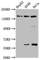 Western Blot; Positive WB detected in: HepG2 whole cell lysate, A549 whole cell lysate, Hela whole cell lysate; All lanes: NAIP antibody at 3.3µg/ml; Secondary; Goat polyclonal to rabbit IgG at 1/50000 dilution; Predicted band size: 160, 142 kDa; Observed band size: 160 kDa