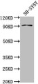 Western Blot; Positive WB detected in: SH-SY5Y whole cell lysate; All lanes: GPLD1 antibody at 1:2000; Secondary; Goat polyclonal to rabbit IgG at 1/50000 dilution; Predicted band size: 93, 20 kDa; Observed band size: 93 kDa;
