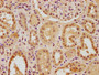 IHC image diluted at 1:100 and staining in paraffin-embedded human kidney tissue performed on a Leica BondTM system. After dewaxing and hydration, antigen retrieval was mediated by high pressure in a citrate buffer (pH 6.0). Section was blocked with 10% normal goat serum 30min at RT. Then primary antibody (1% BSA) was incubated at 4°C overnight. The primary is detected by a biotinylated secondary antibody and visualized using an HRP conjugated SP system.