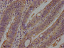 IHC image of CAC11631 diluted at 1:100 and staining in paraffin-embedded human colon cancer performed on a Leica BondTM system. After dewaxing and hydration, antigen retrieval was mediated by high pressure in a citrate buffer (pH 6.0). Section was blocked with 10% normal goat serum 30min at RT. Then primary antibody (1% BSA) was incubated at 4°C overnight. The primary is detected by a biotinylated secondary antibody and visualized using an HRP conjugated SP system.