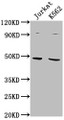 Western Blot; Positive WB detected in: Jurkat whole cell lysate, K562 whole cell lysate; All lanes: PSMD6 antibody at 1:2000; Secondary; Goat polyclonal to rabbit IgG at 1/50000 dilution; Predicted band size: 46, 42, 52 kDa; Observed band size: 46 kDa;