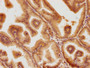 IHC image diluted at 1:100 and staining in paraffin-embedded human prostate tissue performed on a Leica BondTM system. After dewaxing and hydration, antigen retrieval was mediated by high pressure in a citrate buffer (pH 6.0). Section was blocked with 10% normal goat serum 30min at RT. Then primary antibody (1% BSA) was incubated at 4°C overnight. The primary is detected by a biotinylated secondary antibody and visualized using an HRP conjugated SP system.