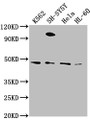 Western Blot; Positive WB detected in: K562 whole cell lysate, SH-SY5Y whole cell lysate, Hela whole cell lysate, HL-60 whole cell lysate; All lanes: RTN4RL2 antibody at 1:2000; Secondary; Goat polyclonal to rabbit IgG at 1/50000 dilution; Predicted band size: 47, 22 kDa; Observed band size: 47 kDa;