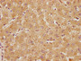 IHC image diluted at 1:100 and staining in paraffin-embedded human liver tissue performed on a Leica BondTM system. After dewaxing and hydration, antigen retrieval was mediated by high pressure in a citrate buffer (pH 6.0). Section was blocked with 10% normal goat serum 30min at RT. Then primary antibody (1% BSA) was incubated at 4°C overnight. The primary is detected by a biotinylated secondary antibody and visualized using an HRP conjugated SP system.
