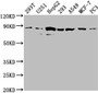 Western Blot; Positive WB detected in: 293T whole cell lysate, U251 whole cell lysate, HepG2 whole cell lysate, 293 whole cell lysate, A549 whole cell lysate, MCF-7 whole cell lysate, PC3 whole cell lysate; All lanes: AMOTL2 antibody at 1:2000; Secondary; Goat polyclonal to rabbit IgG at 1/50000 dilution; Predicted band size: 86, 92 kDa; Observed band size: 86 kDa;