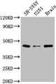 Western Blot; Positive WB detected in: SH-SY5Y whole cell lysate, U251 whole cell lysate, Rat brain tissue; All lanes: LRTM2 antibody at 1:2000; Secondary; Goat polyclonal to rabbit IgG at 1/50000 dilution; Predicted band size: 42 kDa; Observed band size: 42 kDa