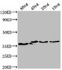 Western Blot; Positive WB detected in Recombinant protein; All lanes: bepA antibody at 1:2000; Secondary; Goat polyclonal to rabbit IgG at 1/50000 dilution; Predicted band size: 35 kDa; Observed band size: 37 kDa