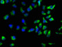 Immunofluorescence staining of Hela cells with CAC11647 at 1:133, counter-stained with DAPI. The cells were fixed in 4% formaldehyde, permeabilized using 0.2% Triton X-100 and blocked in 10% normal Goat Serum. The cells were then incubated with the antibody overnight at 4°C. The secondary antibody was Alexa Fluor 488-congugated AffiniPure Goat Anti-Rabbit IgG(H+L).