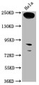 Western Blot; Positive WB detected in: Hela whole cell lysate; All lanes: RTTN antibody at 1:1000; Secondary; Goat polyclonal to rabbit IgG at 1/50000 dilution; Predicted band size: 249, 68, 246, 99 kDa; Observed band size: 249 kDa;