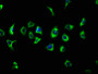 Immunofluorescence staining of A549 cells with CAC11651 at 1:133, counter-stained with DAPI. The cells were fixed in 4% formaldehyde, permeabilized using 0.2% Triton X-100 and blocked in 10% normal Goat Serum. The cells were then incubated with the antibody overnight at 4°C. The secondary antibody was Alexa Fluor 488-congugated AffiniPure Goat Anti-Rabbit IgG(H+L).