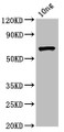 Western Blot; Positive WB detected in Recombinant protein; All lanes: ompC antibody at 4.5µg/ml; Secondary; Goat polyclonal to rabbit IgG at 1/50000 dilution; Predicted band size: 60 kDa; Observed band size: 60 kDa
