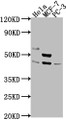 Western Blot; ,Positive WB detected in: Hela whole cell lysate, MCF-7 whole cell lysate, PC-3 whole cell lysate; ,All lanes: POU4F1 antibody at 1:2000; ,Secondary; ,Goat polyclonal to rabbit IgG at 1/50000 dilution; ,Predicted band size: 43, 34 kDa; ,Observed band size: 43 kDa;