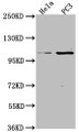 Western Blot; Positive WB detected in: Hela whole cell lysate, PC3 whole cell lysate; All lanes: PKN3 antibody at 1:2000; Secondary; Goat polyclonal to rabbit IgG at 1/50000 dilution; Predicted band size: 100 kDa; Observed band size: 100 kDa;
