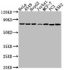 Western Blot; Positive WB detected in: Hela whole cell lysate, A549 whole cell lysate, HepG2 whole cell lysate, Jurkat whole cell lysate, MCF-7 whole cell lysate, PC3 whole cell lysate, K562 whole cell lysate; All lanes: HSPA1B antibody at 1:2000; Secondary; Goat polyclonal to rabbit IgG at 1/50000 dilution; Predicted band size: 71 kDa; Observed band size: 71 kDa;