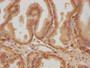 IHC image of CAC11676 diluted at 1:300 and staining in paraffin-embedded human prostate tissue performed on a Leica BondTM system. After dewaxing and hydration, antigen retrieval was mediated by high pressure in a citrate buffer (pH 6.0). Section was blocked with 10% normal goat serum 30min at RT. Then primary antibody (1% BSA) was incubated at 4°C overnight. The primary is detected by a biotinylated secondary antibody and visualized using an HRP conjugated SP system.