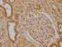 IHC image of CAC11677 diluted at 1:100 and staining in paraffin-embedded human kidney tissue performed on a Leica BondTM system. After dewaxing and hydration, antigen retrieval was mediated by high pressure in a citrate buffer (pH 6.0). Section was blocked with 10% normal goat serum 30min at RT. Then primary antibody (1% BSA) was incubated at 4°C overnight. The primary is detected by a biotinylated secondary antibody and visualized using an HRP conjugated SP system.