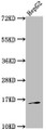 Western Blot; Positive WB detected in: HepG2 whole cell lysate; All lanes: TAC1 antibody at 1:2000; Secondary; Goat polyclonal to rabbit IgG at 1/50000 dilution; Predicted band size: 16, 14, 12 kDa; Observed band size: 16 kDa;