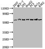 Western Blot; Positive WB detected in: 293T whole cell lysate, MCF-7 whole cell lysate, 293 whole cell lysate, HepG2 whole cell lysate, PC-3 whole cell lysate, Hela whole cell lysate, K562 whole cell lysate; All lanes: APCDD1 antibody at 1:1000; Secondary; Goat polyclonal to rabbit IgG at 1/50000 dilution; Predicted band size: 59 kDa; Observed band size: 59 kDa;